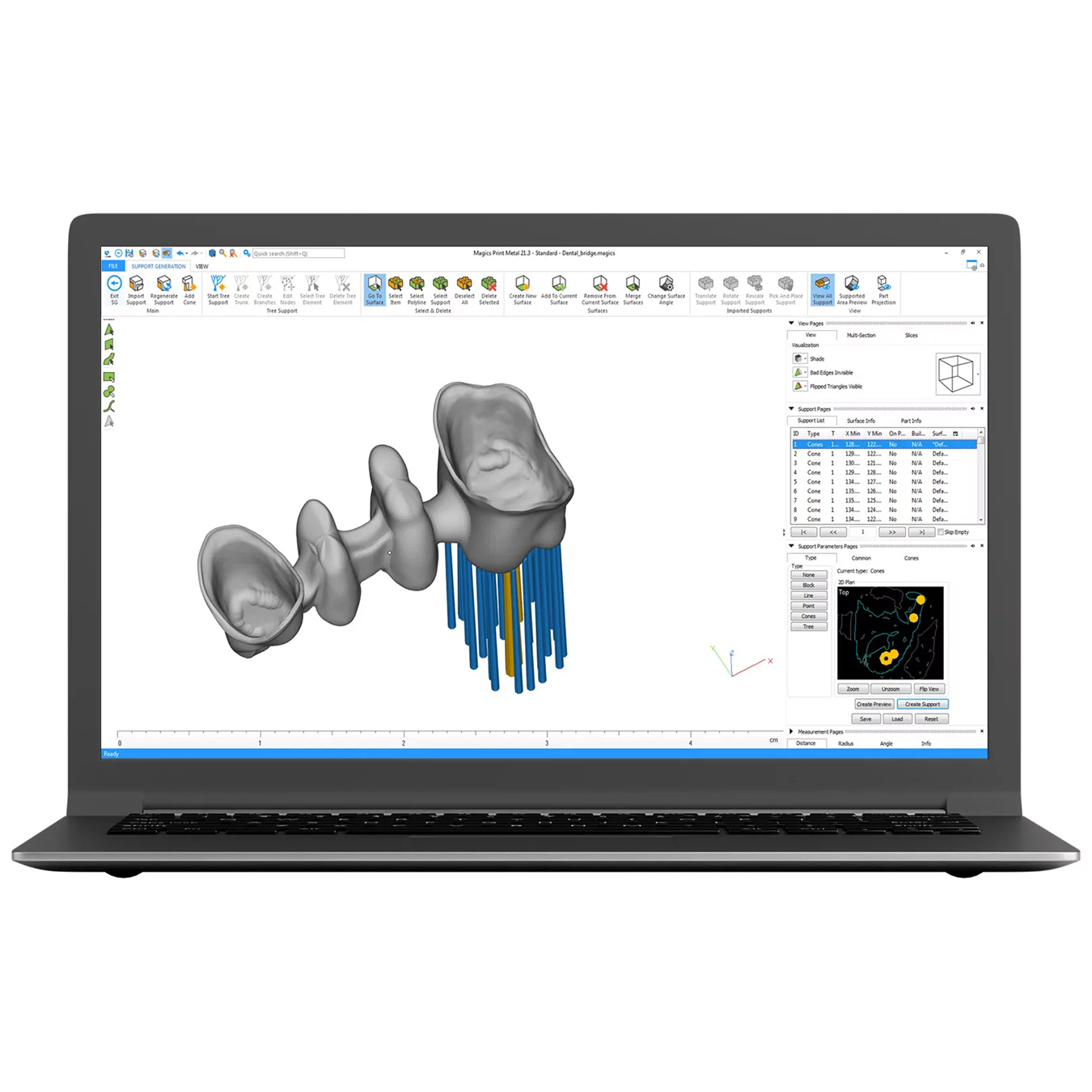 MCAE Materialise 3 matic 